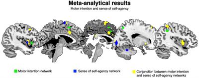 The Brain in (Willed) Action: A Meta-Analytical Comparison of Imaging Studies on Motor Intentionality and Sense of Agency